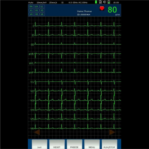 Electrocardiograma ECG Dawei DE-12 - Imagen 3