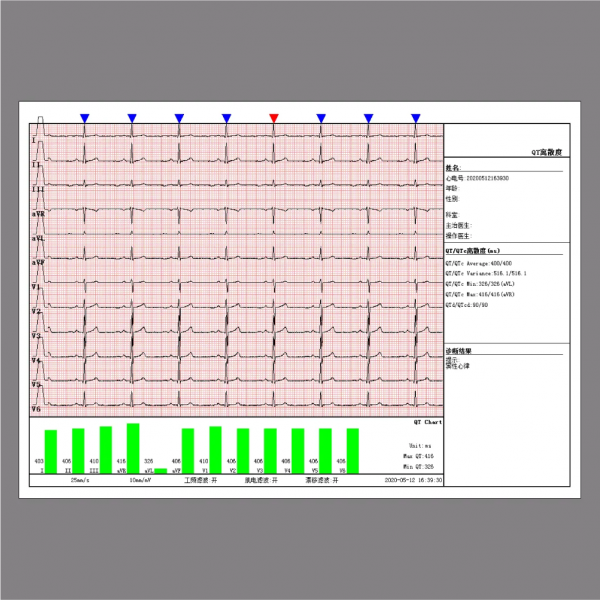 Electrocardiograma ECG Dawei DE-12 - Imagen 4